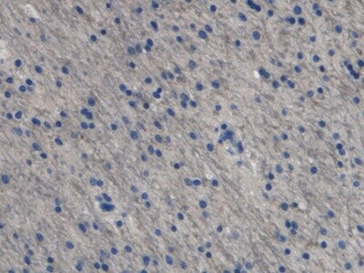 Endothelin-1 Antibody (C10)