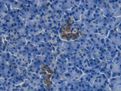 Endothelin-1 Antibody (C10)