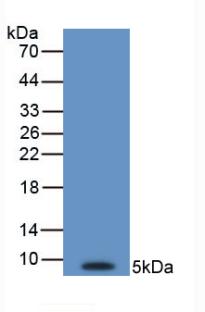 Endothelin-1 Antibody (C3)