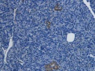 Endothelin-1 Antibody (C3)