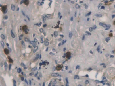 RNASE3 Antibody (C3)