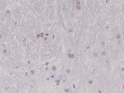 HSP20/HSPB6 Antibody (C10)