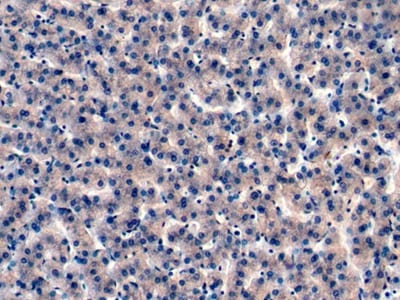IGFBP-4 Antibody (C1)