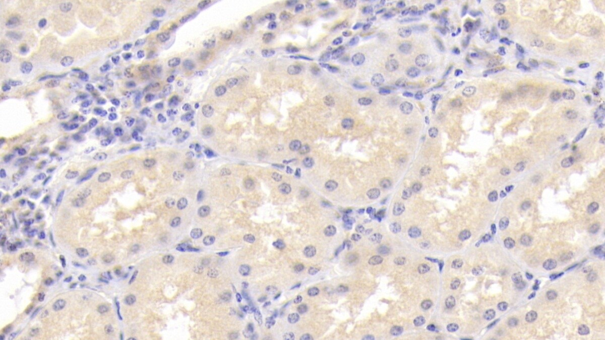 Osteoprotegerin/TNFRSF11B Antibody (C1)