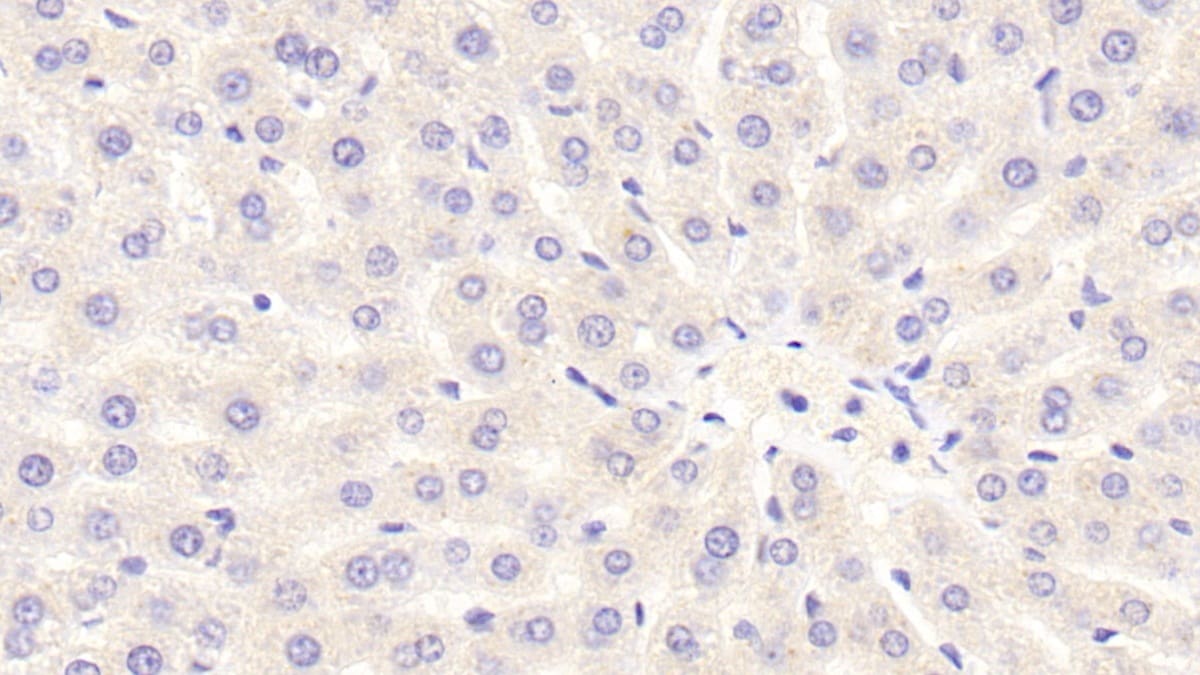 NOX3 Antibody
