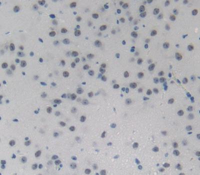NUP214 Antibody