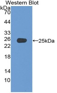 ADCY4 Antibody