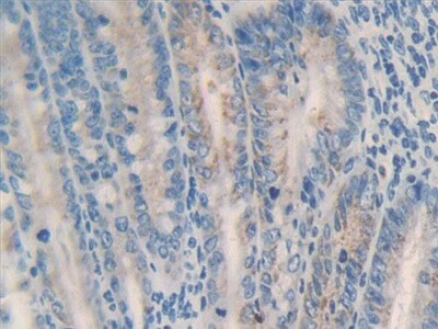 MMP23B Antibody