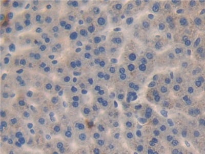 MMP23B Antibody