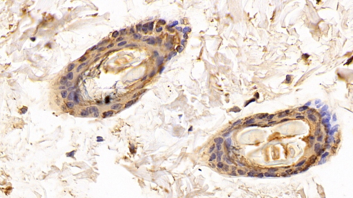 Galectin-7 Antibody (E4)