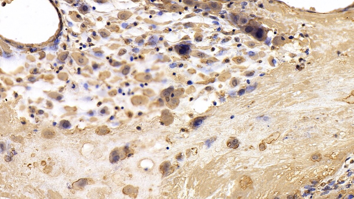 TIMP-3 Antibody (C2)