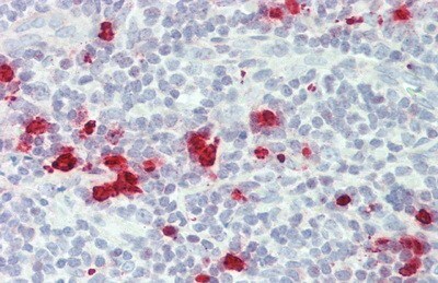 Granzyme M Antibody (D1)