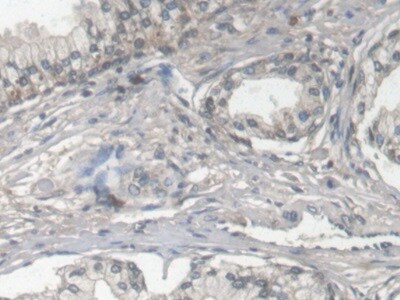Fibulin 1 Antibody (C6)