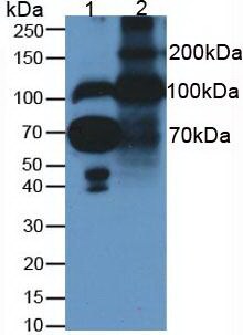 Fibulin 1 Antibody (C6)