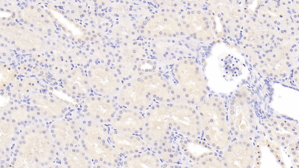 15-Lipoxygenase 1 Antibody (C2)