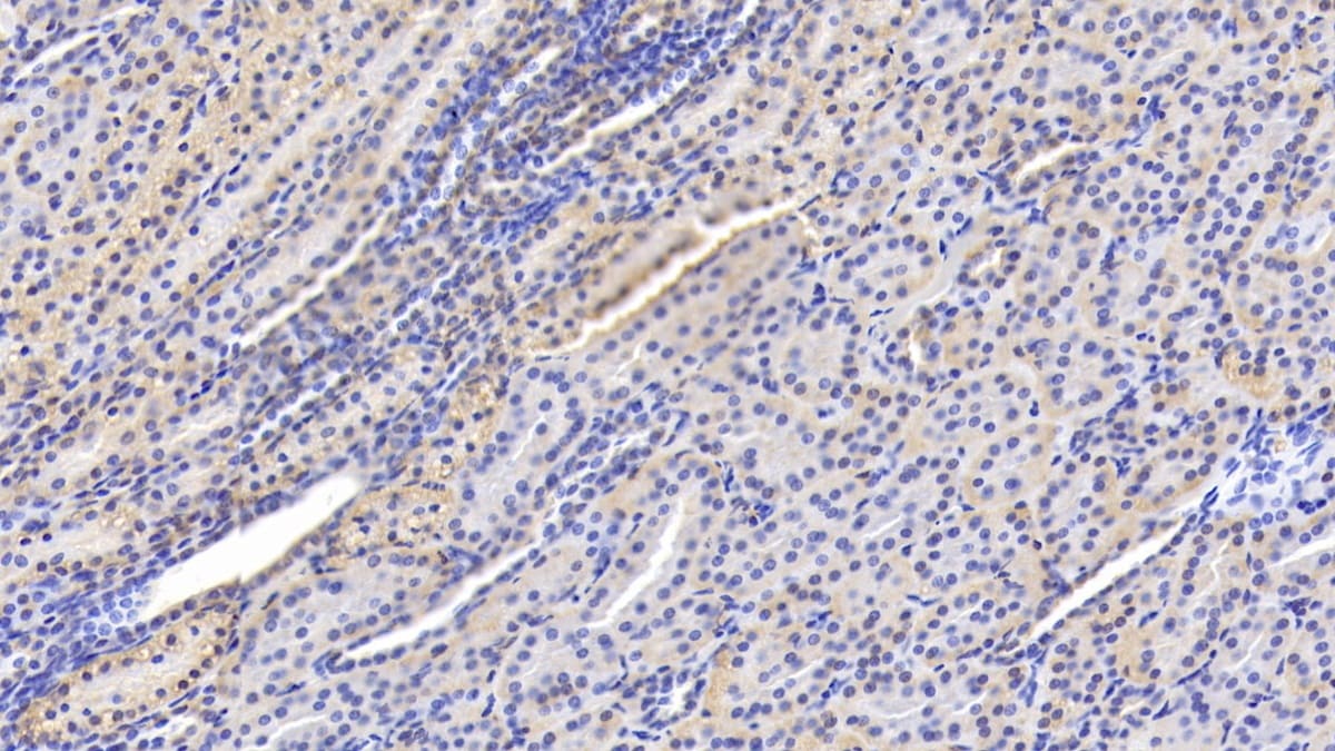15-Lipoxygenase 1 Antibody (D6)