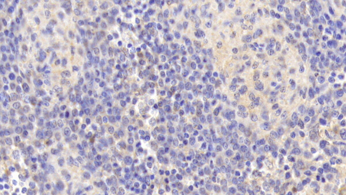 15-Lipoxygenase 1 Antibody (D6)