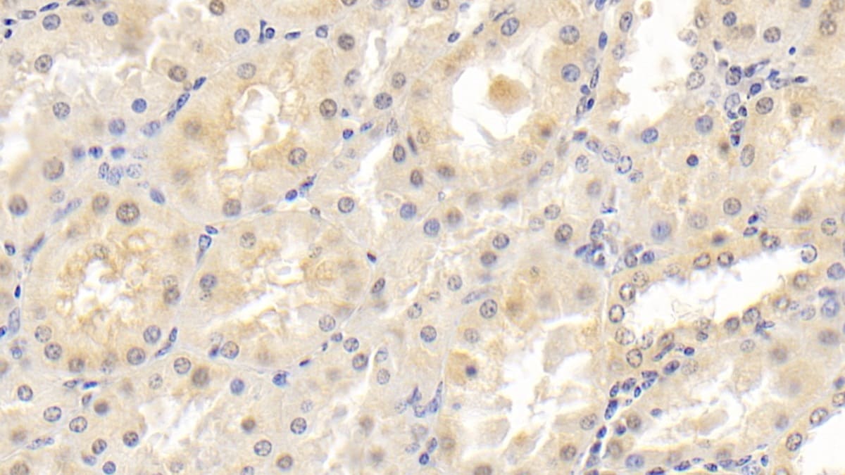 NT-3 Antibody (D1)
