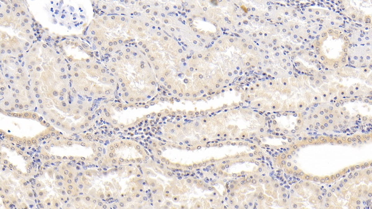 NT-3 Antibody (D3)