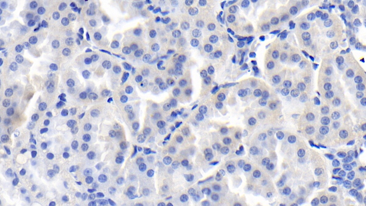 FGF-9 Antibody (E8)