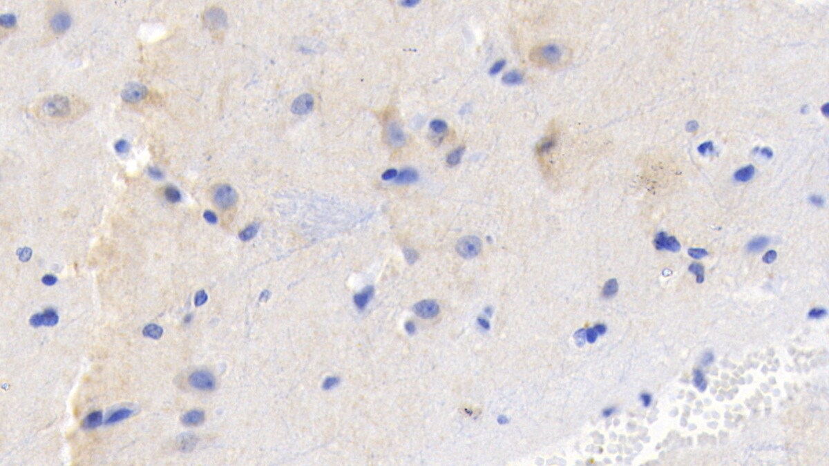 FGF-9 Antibody (E16)
