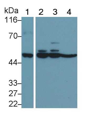MMP-11 Antibody (D1)