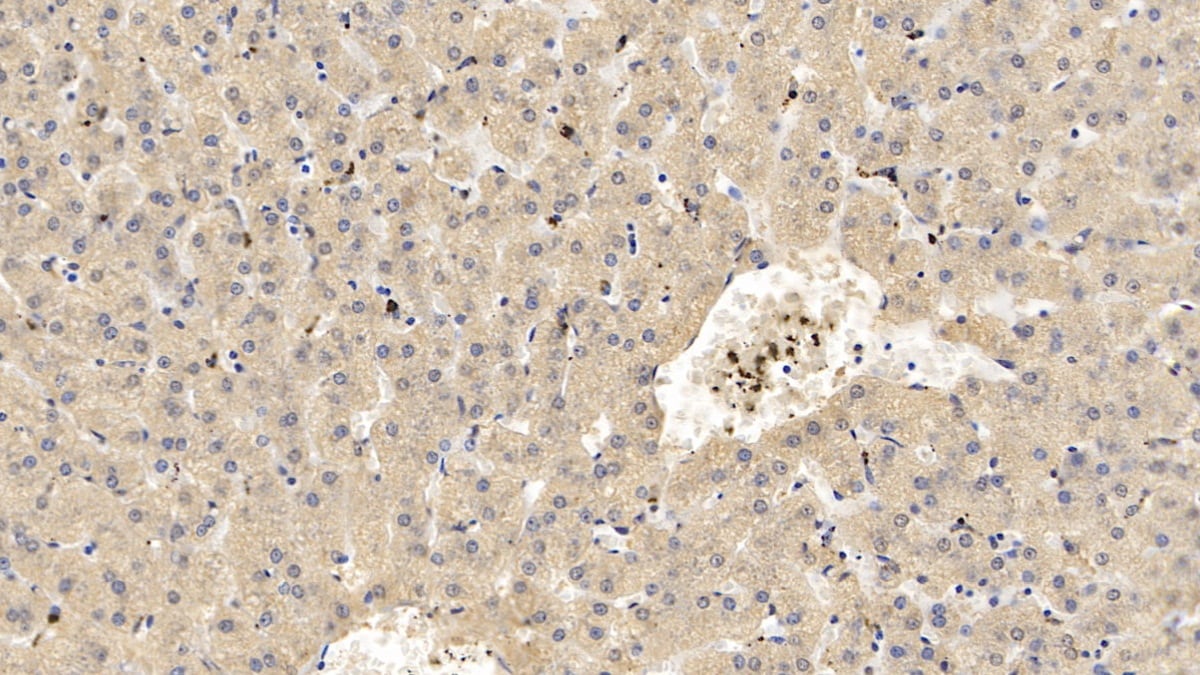 Apolipoprotein C1 Antibody (C14)