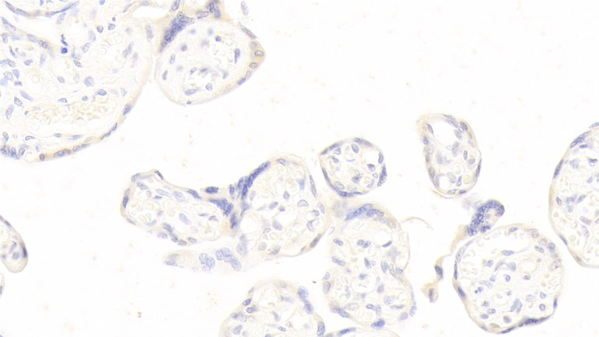 Pappalysin-1/PAPP-A Antibody (H6)