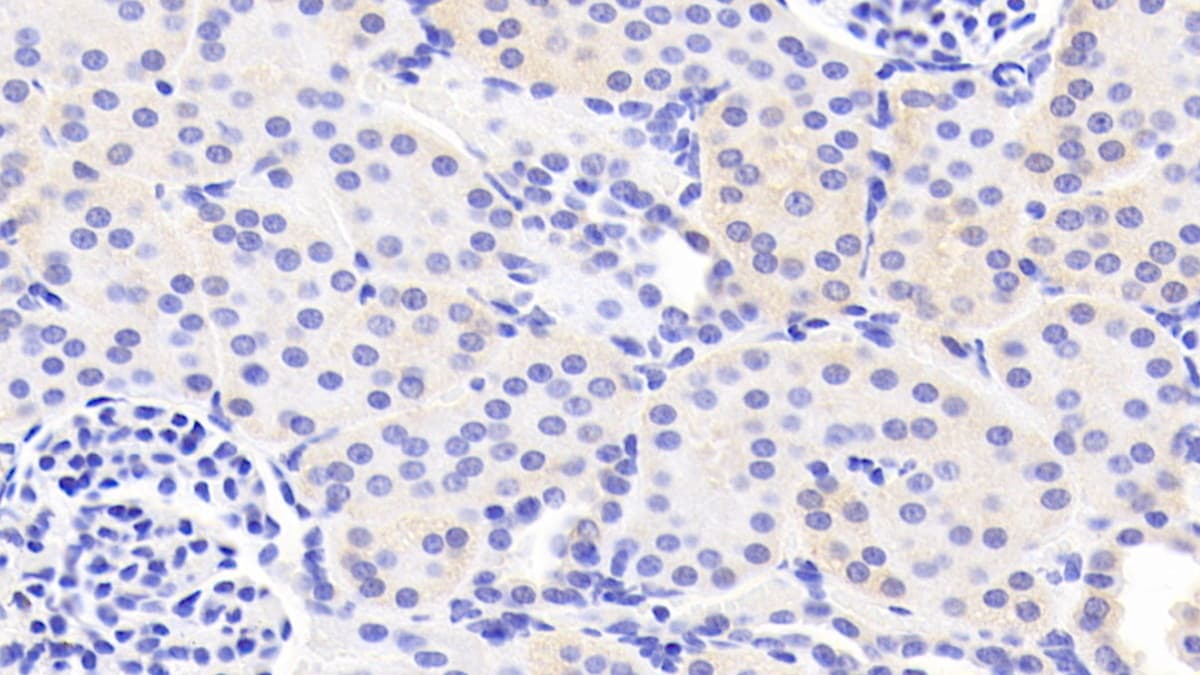 Laminin alpha 3 Antibody