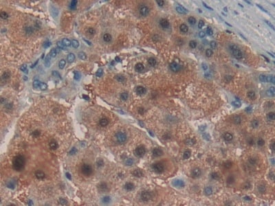 Laminin alpha 3 Antibody