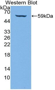 Collagen IV alpha3 Antibody