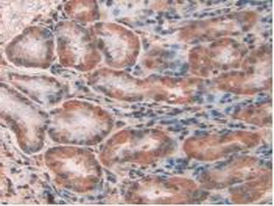 CLIC1 Antibody
