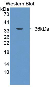 Thromboxane A2 R/TBXA2R Antibody