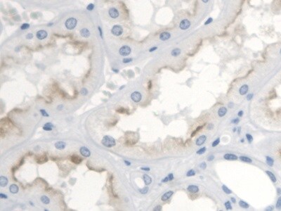 Thromboxane A2 R/TBXA2R Antibody