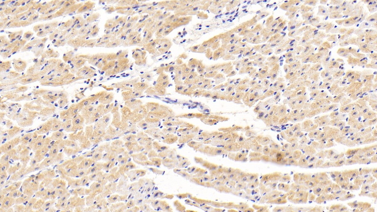 TNKS2 Antibody