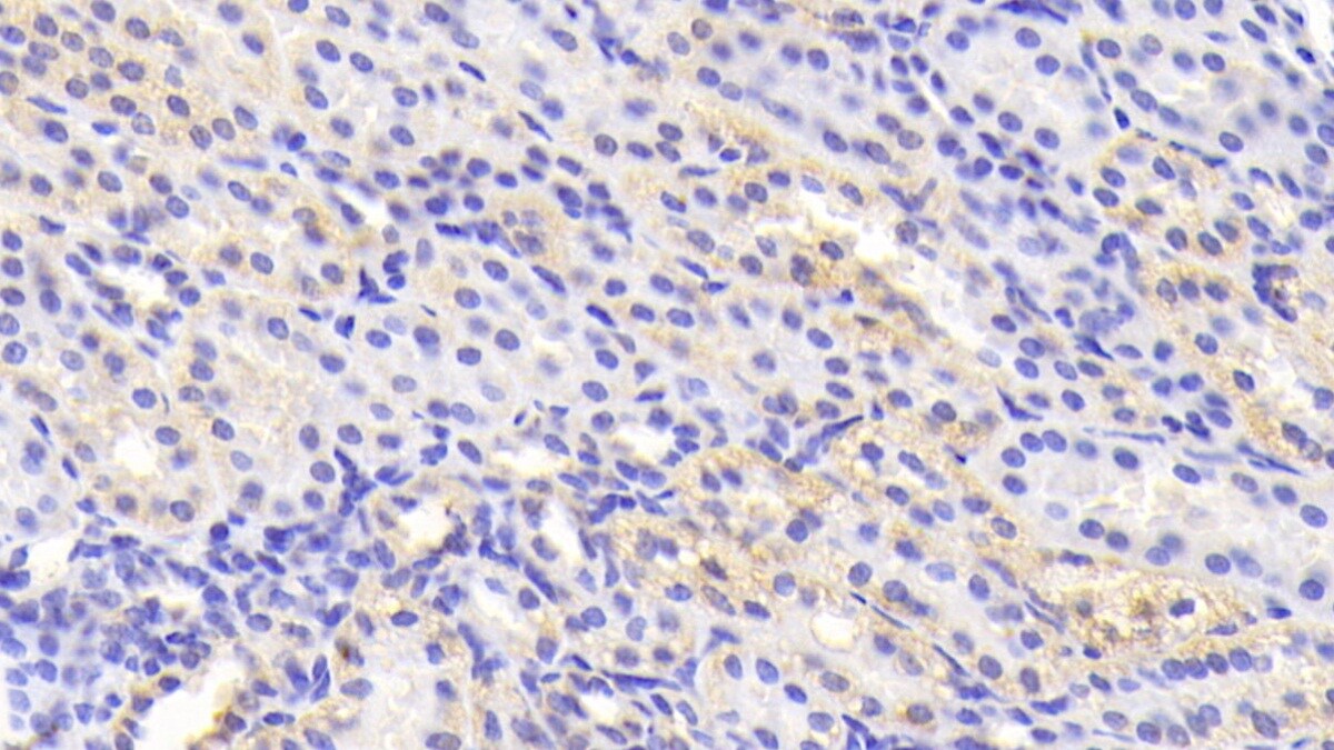 TNKS2 Antibody