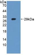 TNKS2 Antibody