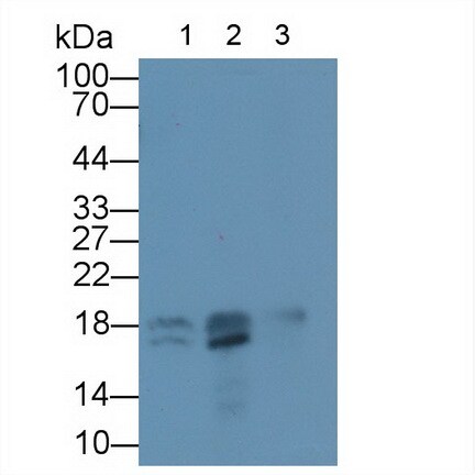 TNNC2 Antibody