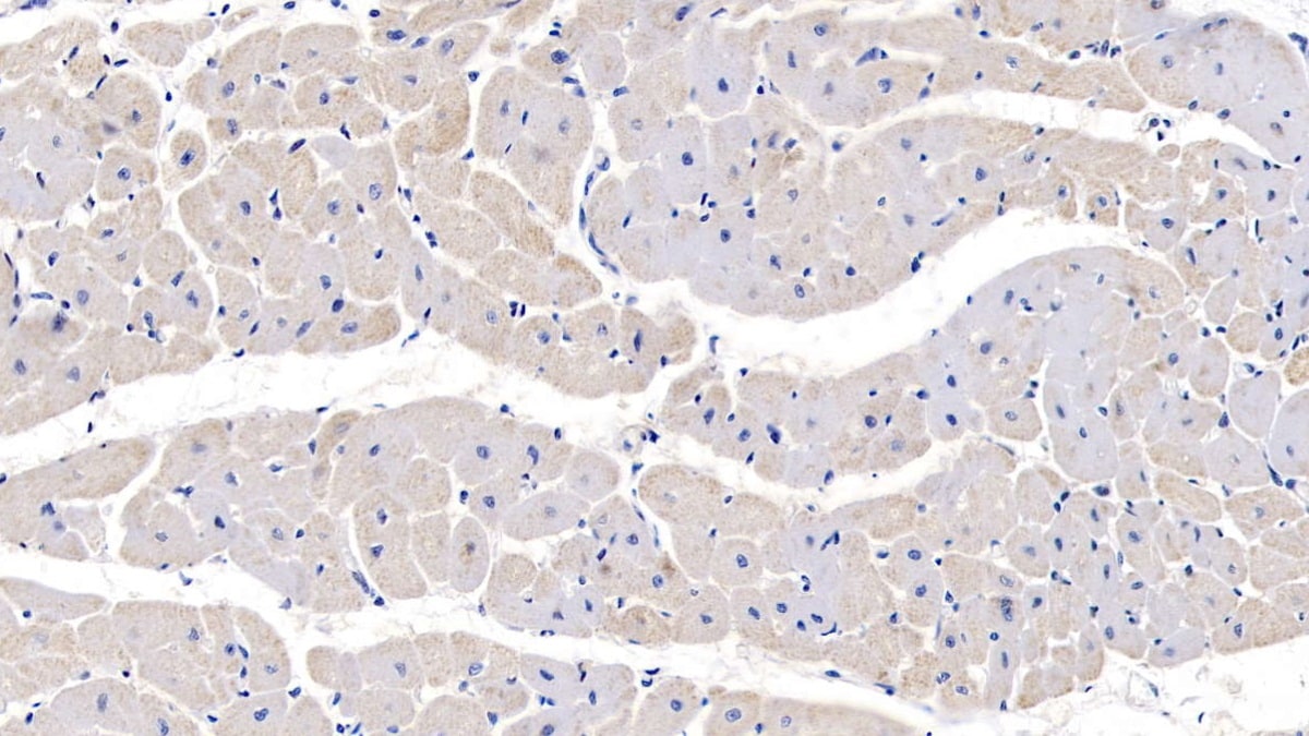 PRL-3/PTP4A3 Antibody