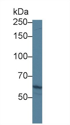 ABCA3 Antibody