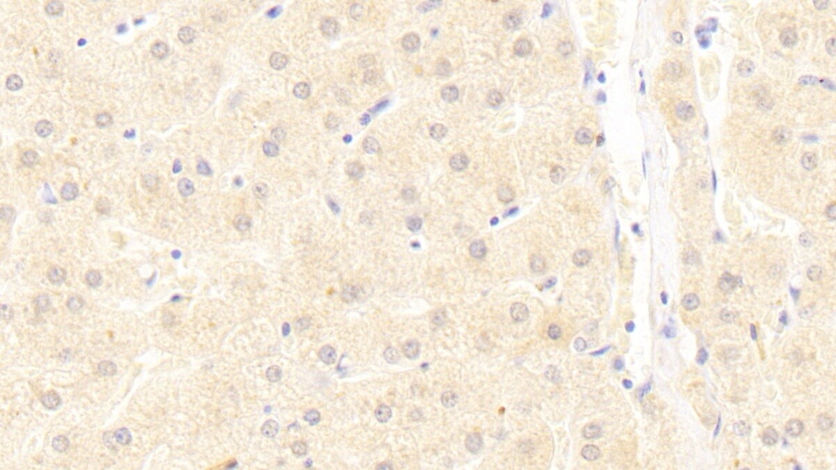 UBAP2 Antibody