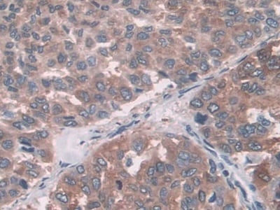 FUT6 Antibody