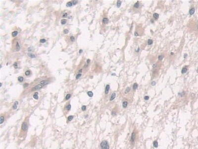 FUT6 Antibody