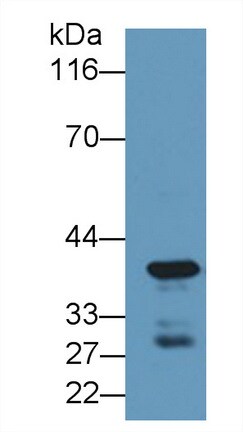 Carboxypeptidase A4/CPA4 Antibody
