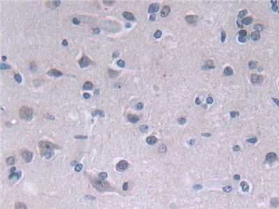 Fatty acid desaturase 2 Antibody