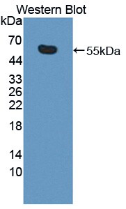 KIF18A Antibody