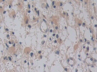TMPRSS4 Antibody