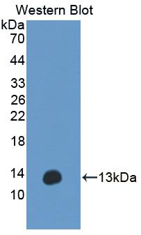 ANO6 Antibody