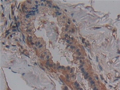 ANO6 Antibody