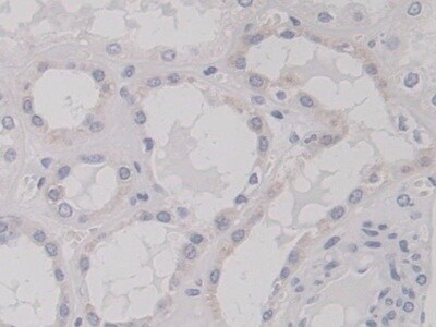 TNS3 Antibody